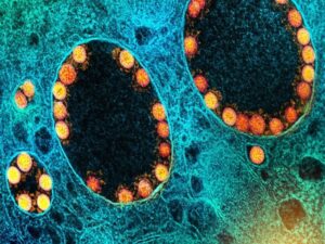 Internacional - França identifica nova variante do coronavírus 